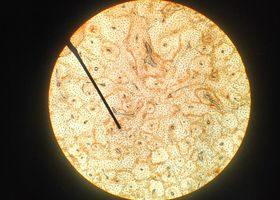 Phase-contrast micrograph of engineered yeast colonies grown on lignocellulosic hydrolysate